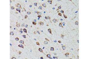 Immunohistochemistry of paraffin-embedded Rat brain using HEXA Polyclonal Antibody at dilution of 1:100 (40x lens). (Hexosaminidase A 抗体)