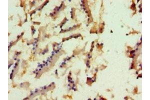 Immunohistochemistry of paraffin-embedded human prostate tissue using ABIN7157655 at dilution of 1:100 (KIF6 抗体  (AA 565-814))