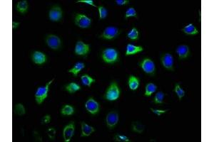 Immunofluorescence staining of A549 cells with ABIN7154582 at 1:66, counter-stained with DAPI. (DIRAS1 抗体  (AA 1-195))