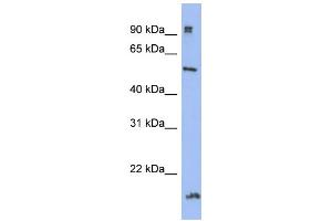 WB Suggested Anti-HDAC2 Antibody Titration:  0. (HDAC2 抗体  (Middle Region))