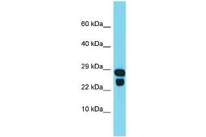 Western Blotting (WB) image for anti-IdnK Gluconokinase Homolog (IDNK) (Middle Region) antibody (ABIN2790936) (IdnK 抗体  (Middle Region))