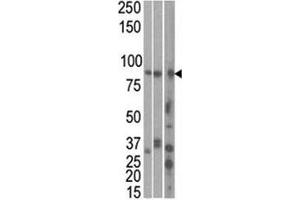 The MARK1 antibody used in western blot to detect MARK1 in HeLa, T47D, and mouse brain cell line/ tissue lysate (left to right)