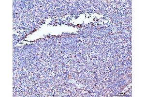 IHC analysis of Filamin B/FLNB using anti-Filamin B/FLNB antibody (ABIN7601606). (FLNB 抗体  (AA 397-701))