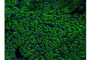 Image no. 3 for anti-Cardiotin antibody (ABIN335361) (Cardiotin 抗体)