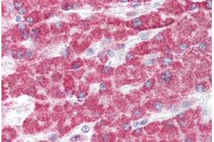 Human Liver (formalin-fixed, paraffin-embedded) stained with GCLC antibody ABIN337056 at 5 ug/ml followed by biotinylated goat anti-rabbit IgG secondary antibody ABIN481713, alkaline phosphatase-streptavidin and chromogen. (GCLC 抗体  (AA 295-313))