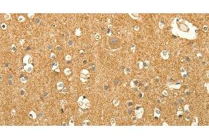 Immunohistochemistry of paraffin-embedded Human brain tissue using EDG7 Polyclonal Antibody at dilution 1:40 (LPAR3 抗体)