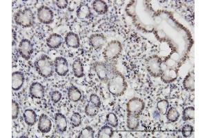 Immunoperoxidase of monoclonal antibody to ROD1 on formalin-fixed paraffin-embedded human small Intestine. (PTBP3 抗体  (AA 16-114))