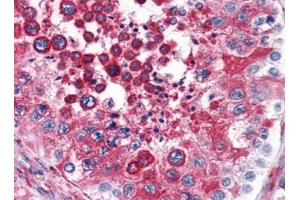 Image no. 1 for anti-Reticulon 4 (RTN4) (N-Term) antibody (ABIN372912) (Reticulon 4 抗体  (N-Term))