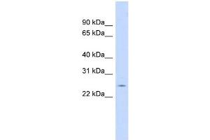 WB Suggested Anti-CRP Antibody Titration:  0. (CRP 抗体  (N-Term))