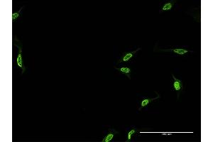 Immunofluorescence (IF) image for anti-Cleavage and Polyadenylation Specific Factor 6, 68kDa (CPSF6) (AA 37-136) antibody (ABIN524444)