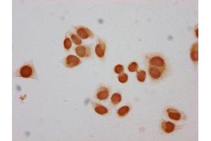 Immunocytochemistry analysis of ABIN7139590 diluted at 1:30 and staining in Hela cells performed on a Leica BondTM system. (Histone H2B 抗体  (meLys12))