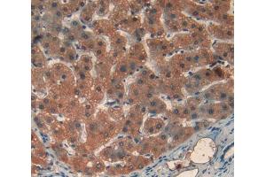 Used in DAB staining on fromalin fixed paraffin- embedded liver tissue (Transferrin Receptor 2 抗体  (AA 493-785))