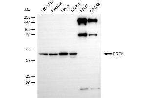 Western blotting analysis using PREB antibody (ABIN7799913). (Recombinant PREB 抗体)