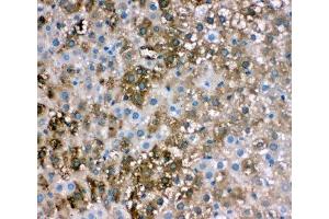 IHC-P: FABP1 antibody testing of rat liver tissue (FABP1 (liver) 抗体  (N-Term))