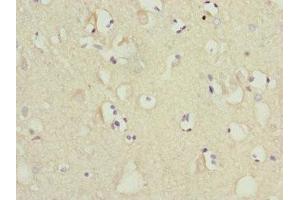 Immunohistochemistry of paraffin-embedded human brain tissue using ABIN7159842 at dilution of 1:100 (MTCH1 抗体  (AA 100-250))