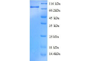 SDS-PAGE (SDS) image for Keratin 8 (KRT8) (AA 2-483), (full length) protein (GST tag) (ABIN1047298)