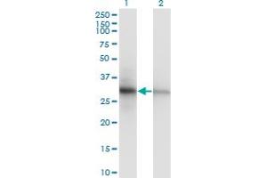 Western Blotting (WB) image for anti-Proliferating Cell Nuclear Antigen (PCNA) (AA 1-261) antibody (ABIN562136)
