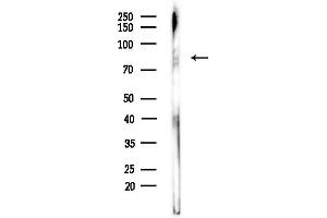 anti-Acyl-CoA Oxidase 2, Branched Chain (Acox2) (Internal Region) antibody