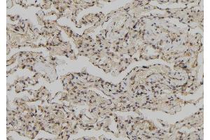 ABIN6278135 at 1/100 staining Human lung tissue by IHC-P. (Annexin IV 抗体  (Internal Region))