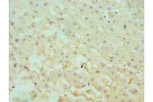 Immunohistochemistry of paraffin-embedded human liver tissue using ABIN7166366 at dilution of 1:100 (SERPINA1 抗体  (AA 165-444))