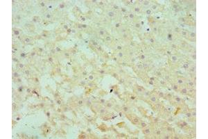 Immunohistochemistry (IHC) image for anti-serpin Peptidase Inhibitor, Clade A (Alpha-1 Antiproteinase, Antitrypsin), Member 1 (SERPINA1) (AA 165-444) antibody (ABIN7166366)