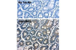 Immunohistochemistry (IHC) image for anti-BCL2-Associated X Protein (BAX) (N-Term) antibody (ABIN6254209)