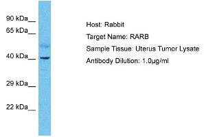 Host: Rabbit Target Name: RARB Sample Type: Uterus Tumor lysates Antibody Dilution: 1. (Retinoic Acid Receptor beta 抗体  (N-Term))