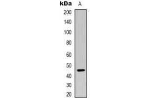 Western blot analysis of Plasma Kallikrein HC expression in Hela (A) whole cell lysates.
