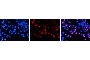 DNAJB1 antibody - N-terminal region (ARP54795_P050) Catalog Number: ARP54795_P050  Formalin Fixed Paraffin Embedded Tissue: Human Lung Tissue  Observed Staining: Nucleus of pneumocytes Primary Antibody Concentration: 1:100  Secondary Antibody: Donkey anti-Rabbit-Cy3  Secondary Antibody Concentration: 1:200  Magnification: 20X  Exposure Time: 0.