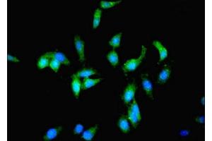 Immunofluorescent analysis of Hela cells using ABIN7163258 at dilution of 1:100 and Alexa Fluor 488-congugated AffiniPure Goat Anti-Rabbit IgG(H+L) (PCK1 抗体  (AA 1-622))