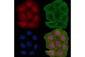 ABIN6264679 and ABIN6278276 staining Hela cells(30 min of UV treatment) by IF/ICC. (RCC1 抗体  (N-Term))