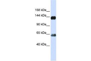 RAPGEF1 antibody used at 1 ug/ml to detect target protein. (GRF2 抗体)