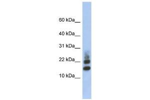 RPS15A antibody used at 1 ug/ml to detect target protein.