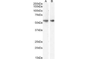 ABIN5539774 (1µg/ml) staining of Rat (A) and (0. (GLP1R 抗体  (Internal Region))