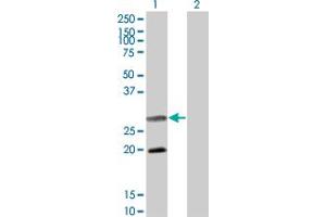 Western Blot analysis of DIABLO expression in transfected 293T cell line by DIABLO monoclonal antibody (M02A), clone 4F9. (DIABLO 抗体  (AA 119-218))