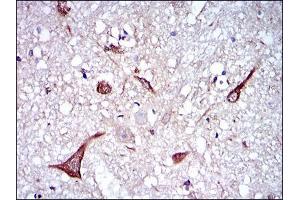Immunohistochemical analysis of paraffin-embedded brain tissues using NEFL mouse mAb with DAB staining. (NEFL 抗体)