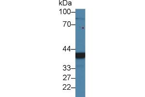 Western Blot; Sample: Human 293T cell lysate; Primary Ab: 2µg/ml Rabbit Anti-Mouse CHRDL1 Antibody Second Ab: 0. (CHRDL1 抗体  (AA 272-447))