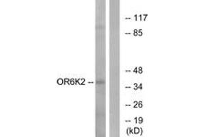 Western blot analysis of extracts from HeLa cells, using OR6K2 Antibody.