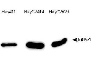 Image no. 1 for anti-DNA Repair Protein Apurinic Endonuclease antibody (ABIN5693483) (DNA Repair Protein Apurinic Endonuclease 抗体)