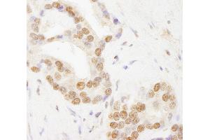 Immunohistochemistry (IHC) image for anti-TAF6 RNA Polymerase II, TATA Box Binding Protein (TBP)-Associated Factor, 80kDa (TAF6) (AA 627-677) antibody (ABIN7453799)