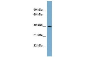 ST8SIA6 antibody used at 1 ug/ml to detect target protein. (ST8SIA6 抗体  (Middle Region))