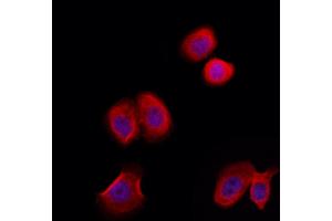 ABIN6258544 and ABIN6274949 staining Hela by IF/ICC. (CLIP3 抗体  (Internal Region))