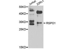 Western blot analysis of extract of various cells, using RSPO1 antibody. (RSPO1 抗体)
