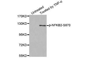 Western blot analysis of extract from MDA-MB-435 cells, using Phospho-NFKB2-S870 antibody (ABIN2988217). (NFKB2 抗体  (pSer870))
