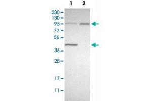 Western Blot analysis of Lane 1: RT-4 and Lane 2: U-251 MG sp cell lysates with DYRK1A polyclonal antibody . (DYRK1A 抗体)