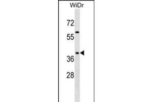 SY Antibody (C-term) 7291b western blot analysis in WiDr cell line lysates (35 μg/lane). (SYAP1 抗体  (C-Term))
