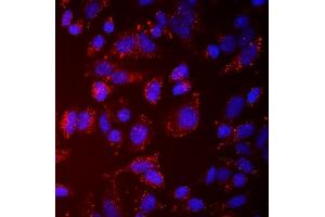 IF analysis of NDP52/CALCOCO2 using anti-NDP52/CALCOCO2 antibody (ABIN7599401).