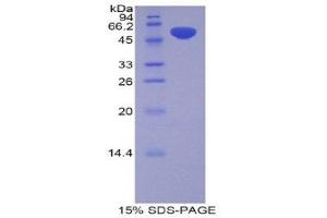 SDS-PAGE (SDS) image for Pregnancy Zone Protein (PZP) (AA 1251-1500) protein (His tag,GST tag) (ABIN1877862)