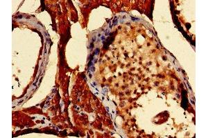 Immunohistochemistry of paraffin-embedded human testis tissue using ABIN7166049 at dilution of 1:100 (S1A16 (AA 1-103) 抗体)