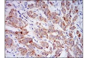 Immunohistochemistry (IHC) image for anti-Membrane Metallo-Endopeptidase (MME) (AA 52-246) antibody (ABIN1724914)